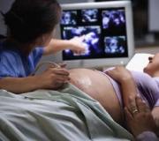 Burta este mică în timpul sarcinii: principalele motive Cum se măsoară burta în timpul sarcinii